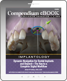 Dynamic Navigation for Dental Implants and Beyond—The Key to a Complete Digital Workflow Ebook Cover