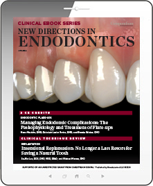 New Directions in Endodontics Ebook Cover