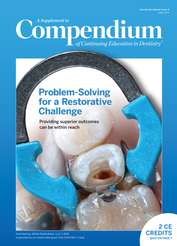 Compendium Supplement-Dentsply Caulk- Restorative June 2013 Cover