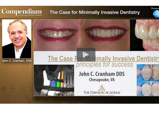 What should be considered in minimally invasive dentistry?