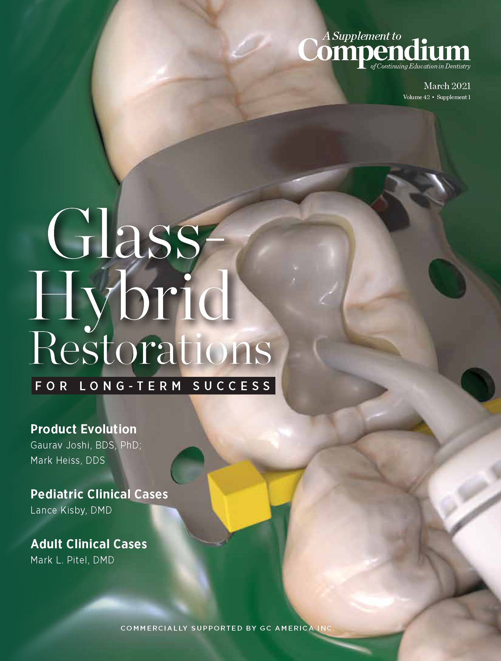 Glass-Hybrid Restorations for Long-term Success March 2021 Cover