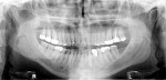 Fig 6. Panoramic radiograph from 2009.