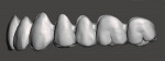 Fig 26. The designed digital denture teeth for the maxillary arch as viewed from the right, frontal, and left.