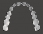 Fig 28. The designed digital denture teeth for the maxillary arch as viewed from the occlusal and gingival aspects.