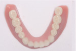 Fig 35. The 3D printed denture bases and teeth assembled for the maxillary and mandibular digital dentures.