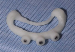 (7.) The 3D printed bone reduction guide, which was created with denture resin.