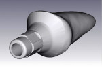 Figure 11. Wax abutment as CAD record.