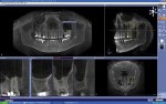 Figure 3  Galileos® CBCT scan data examples (Sirona Dental Systems).