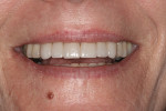 Fig 8. Post-treatment close-up smile.