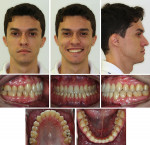 Fig 17. Post-treatment facial and intraoral photographs.