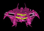 Fig 14. Placement of the zygomatic implants may be executed directly onto the stereolithographic model without the use of computerized planning. As shown here, the model with the implants inserted is scanned and superimposed onto the CT, representing the digital plan.
