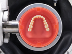 Fig 1. A Baltic Denture Blank is shown inside
the Ceramill System holder. Only the denture
base will have to be milled. With numerous
teeth options available, this system is very
versatile.