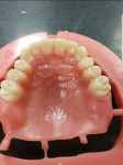 Fig 9. The milled maxillary denture displays a detailed palatal anatomy.