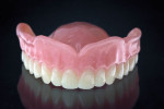 Fig 2. Ivoclar Vivadent materials compose this milled base and teeth, which were designed with 3Shape software.