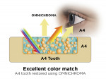 Fig 7. OMNICHROMA provides an excellent color match with either an A1 shaded tooth (Fig 6) or an A4 shaded tooth (Fig 7).