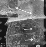 Fig 13. Heat-induced melting of SLA implant surface (double arrow) treated with diode laser. Residual cement on implant surface also exhibited melting and significant cavitational defects (arrow). Original magnification of 20x, Bar = 1 mm. Inset, original magnification of 100x, Bar = 200 μm.