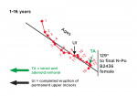 Figure 3. Menton growth direction of a female measured to the nasion-pogonion (N-Po) line (at the oldest age) in degrees. This graphic indicates the major growth that occurs up to 3 or 4 years of age and which remains relatively constant thereafter, by both the early advancement of the mandible and increasing the vertical dimension of the infant’s face height caused both by the direction of growth and tooth eruption.49