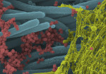 Fig 1. Colorized scanning electron micrograph of SARS-CoV-2. Virus (red) in the cilia (blue) of the upper respiratory tract, with mucous (yellow) covering and potentially protecting the virus from antimicrobials.