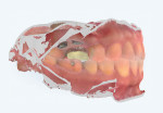 Fig 6. As part of the digital smile design plan, mounted models show a scan of the patient in MIP position.